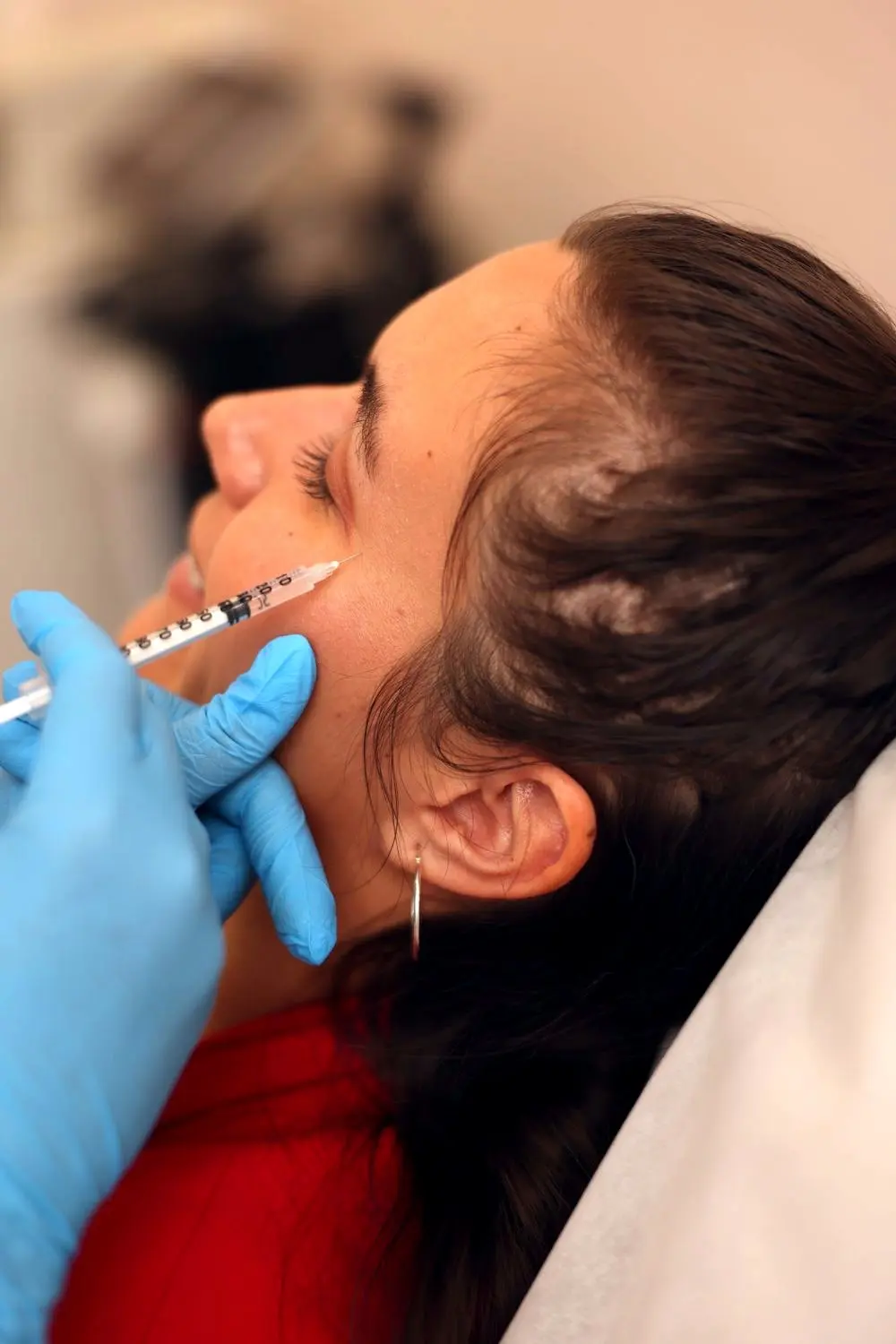 Botox injection into cheek area, Tarzana CA